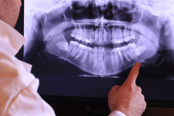 Best Emergency Dental Services for Seniors in Morgantown, MS